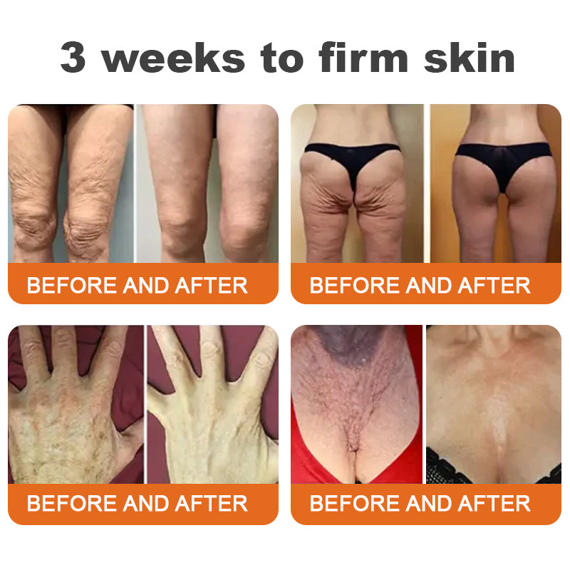 Made and Shipped from UK-Flysmus™ Botox Bee Venom Firming Serum Stick-LAST DAY 70% OFF