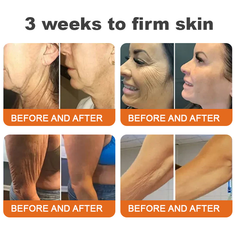 Made and Shipped from UK-Flysmus™ Botox Bee Venom Firming Serum Stick-LAST DAY 70% OFF