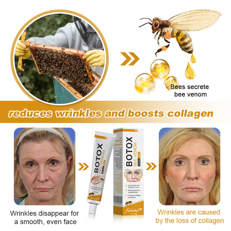 (✅Made and Shipped from UK👨⚕️)✨Flysmus® Botox Bee Venom Wrinkle Removal Cream-Last Day Promotion 70% OFF