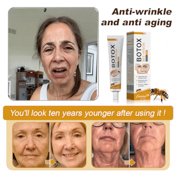 (✅Made and Shipped from UK👨⚕️)✨Flysmus® Botox Bee Venom Wrinkle Removal Cream-Last Day Promotion 70% OFF