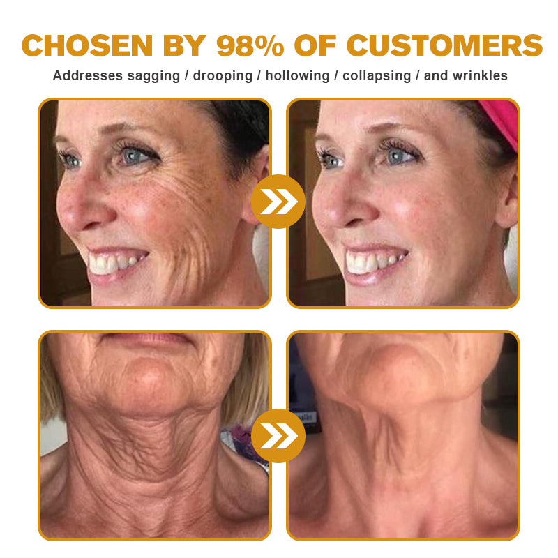 (✅Made and Shipped from UK👨⚕️)✨Flysmus® Botox Bee Venom Wrinkle Removal Cream-Last Day Promotion 70% OFF