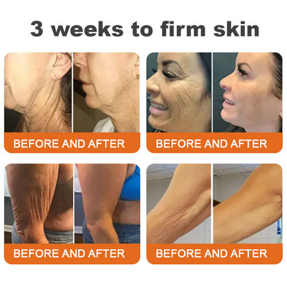 Made and Shipped from UK-Flysmus™ Botox Bee Venom Firming Serum Stick-LAST DAY 70% OFF