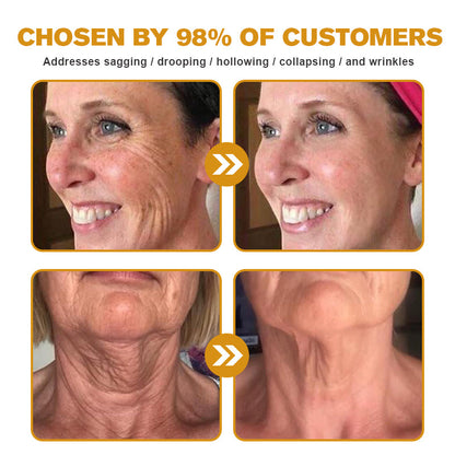 (✅Made and Shipped from UK👨‍⚕️)✨Flysmus® Botox Bee Venom Wrinkle Removal Cream-Last Day Promotion 70% OFF