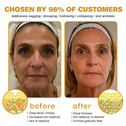 (✅Made and Shipped from UK👨‍⚕️)✨Flysmus® Botox Bee Venom Wrinkle Removal Cream-Last Day Promotion 70% OFF